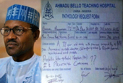 BUHARI ALLEGED MEDICAL REPORT
