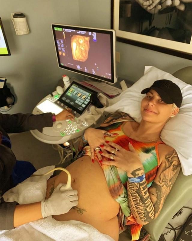 Amber pregnant