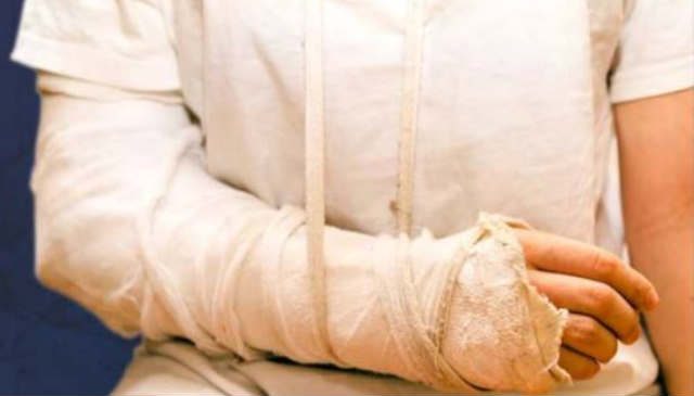 Common Accidents That Lead to Lawsuits