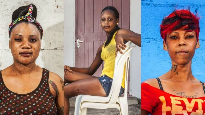 Experts ask Nigeria to explore business process outsourcing 1 Women with bleached skin
