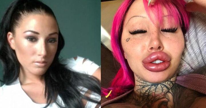 Plastic Surgery Is No Longer Fun – Mary Magdalene 1 Mary Magdalene